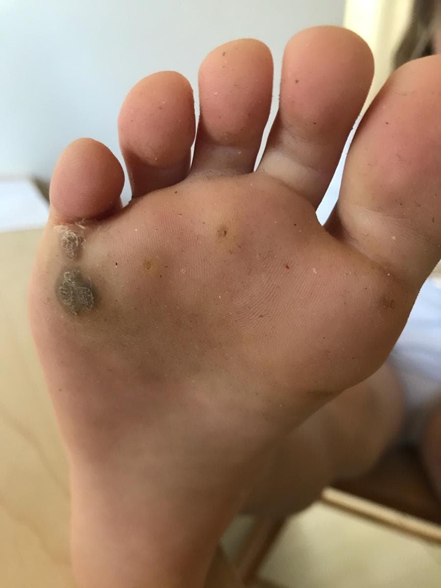 Soins magnétisme peau 1