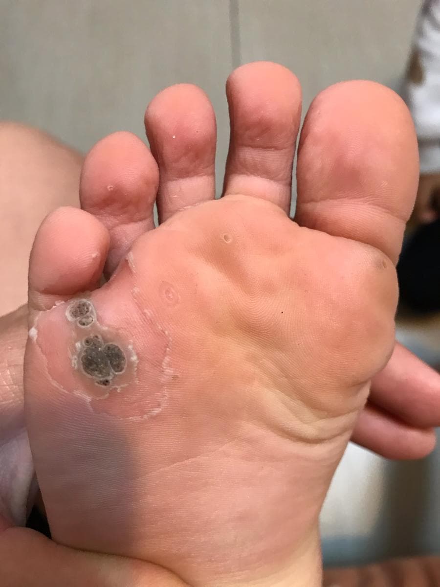 Soins magnétisme peau 2