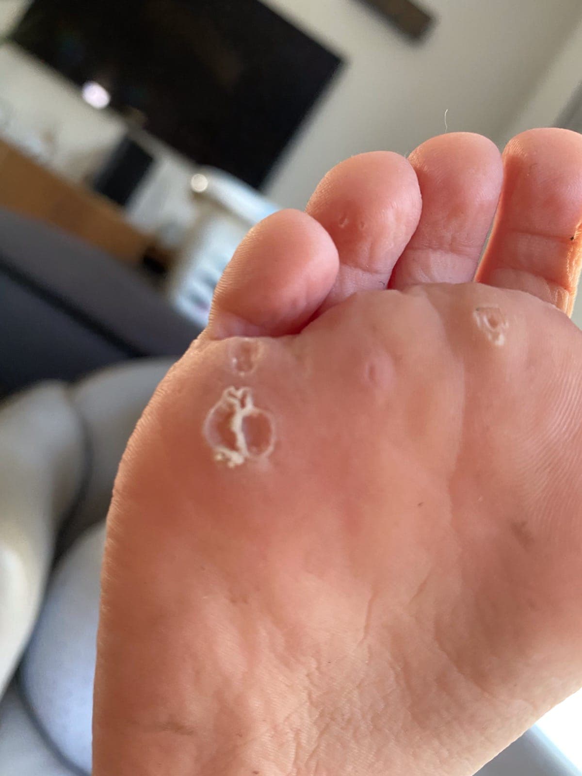 Soins magnétisme peau 3