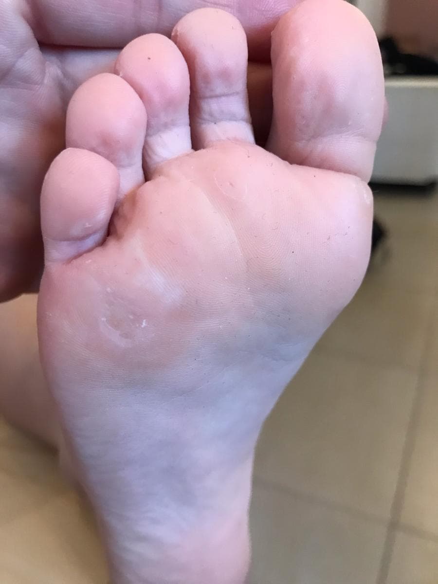 Soins magnétisme peau 4